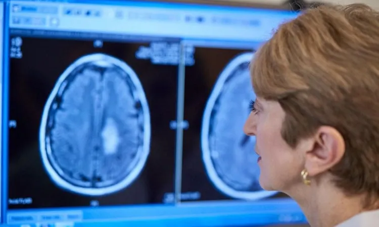 МРТ при опухолях головного мозга