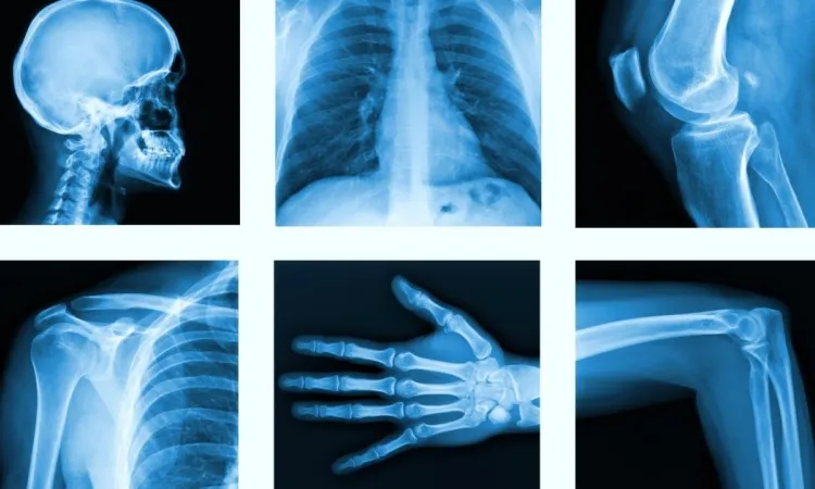 Пример рентгеновских снимков