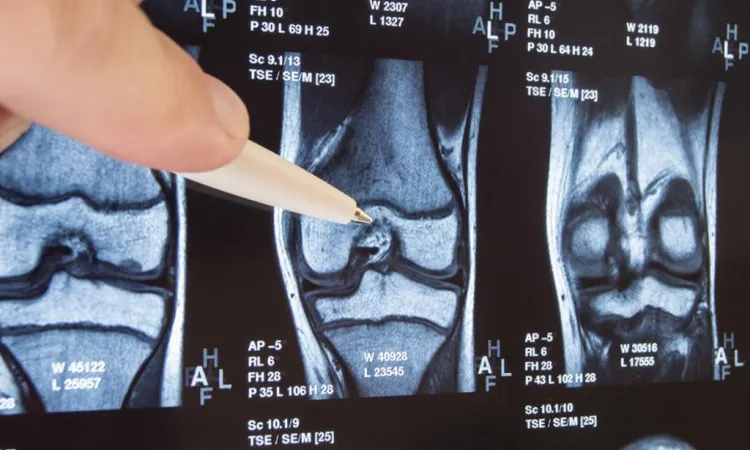 Проведение МРТ коленного сустава в Лианозово