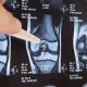 Проведение МРТ коленного сустава в Лианозово