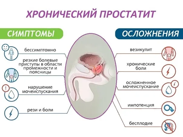 Хронический простатит